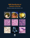 Who Classification of Tumours of the Eye (4TH ed.) 