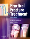 Practical Fracture Treatment, 5. vydanie