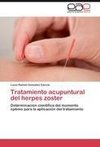 Tratamiento acupuntural del herpes zoster