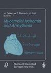 Myocardial Ischemia and Arrhythmia