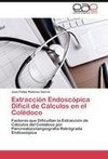 Extracción Endoscópica Difícil de Cálculos en el Colédoco