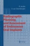Radiographic Planning and Assessment of Endosseous Oral Implants
