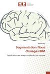 Segmentation floue d'images IRM