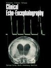 Clinical Echo-Encephalography