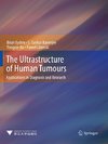The Ultrastructure of Human Tumours