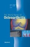The Many Faces of Osteoarthritis