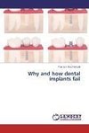 Why and how dental implants fail