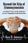 Johnstun, K:  Beyond the Grip of Craniosynostosis