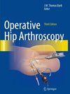 Operative Hip Arthroscopy