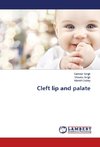 Cleft lip and palate