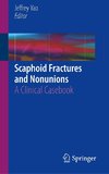 Scaphoid Fractures and Nonunions