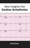 New Insights into Cardiac Arrhythmias