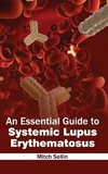 An Essential Guide to Systemic Lupus Erythematosus