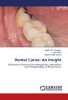 Dental Caries: An insight