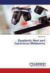 Dysplastic Nevi and Cutaneous Melanoma