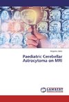 Paediatric Cerebellar Astrocytoma on MRI