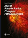 Atlas of Posterior Fundus Changes in Pathologic Myopia