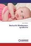 Beckwith Wiedemann syndrome