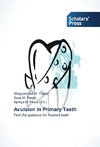 Avulsion in Primary Teeth