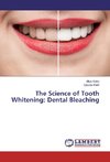 The Science of Tooth Whitening: Dental Bleaching