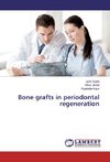 Bone grafts in periodontal regeneration