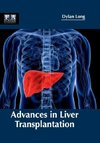 Advances in Liver Transplantation