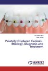 Palatally Displaced Canines : Etiology, Diagnosis and Treatment