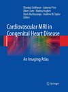 Cardiovascular MRI in Congenital Heart Disease
