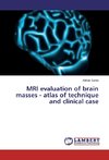 MRI evaluation of brain masses - atlas of technique and clinical case