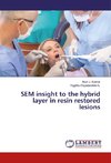 SEM insight to the hybrid layer in resin restored lesions