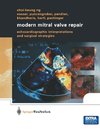 Modern Mitral Valve Repair