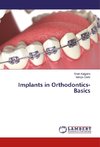 Implants in Orthodontics- Basics