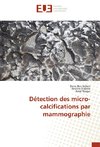 Détection des micro-calcifications par mammographie