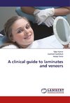 A clinical guide to laminates and veneers