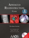 Advanced Reconstruction Knee