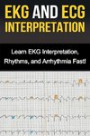 EKG and ECG Interpretation
