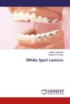 White Spot Lesions