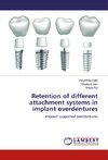 Retention of different attachment systems in implant overdentures