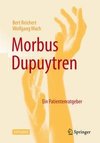 Ratgeber Morbus Dupuytren