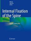 Internal Fixation of the Spine