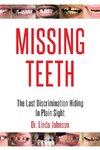 Missing Teeth