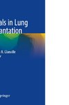 Essentials in Lung Transplantation