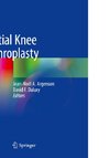 Partial Knee Arthroplasty