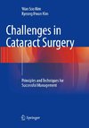 Challenges in Cataract Surgery