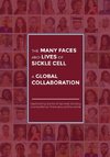 The Many Faces and Lives of Sickle Cell - A Global Collaboration
