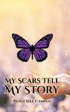 My Scars Tell My Story