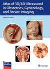 Atlas of 3D and 4D Ultrasound Imaging: Principles and Practice