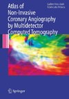 Atlas of Non-Invasive Coronary Angiography by Multidetector Computed Tomography