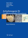 Arrhythmogenic right ventricular cardiomyopathy/dysplasia