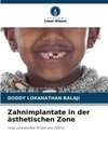 Zahnimplantate in der ästhetischen Zone